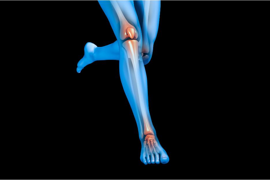 lower limb diagram for compartment syndrome