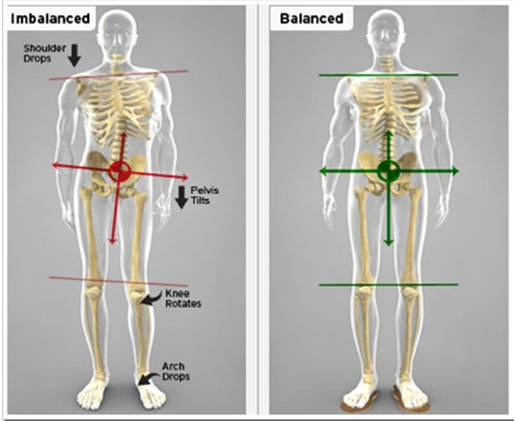 diagram indicating the different aspects of the human body affected by a limb length difference